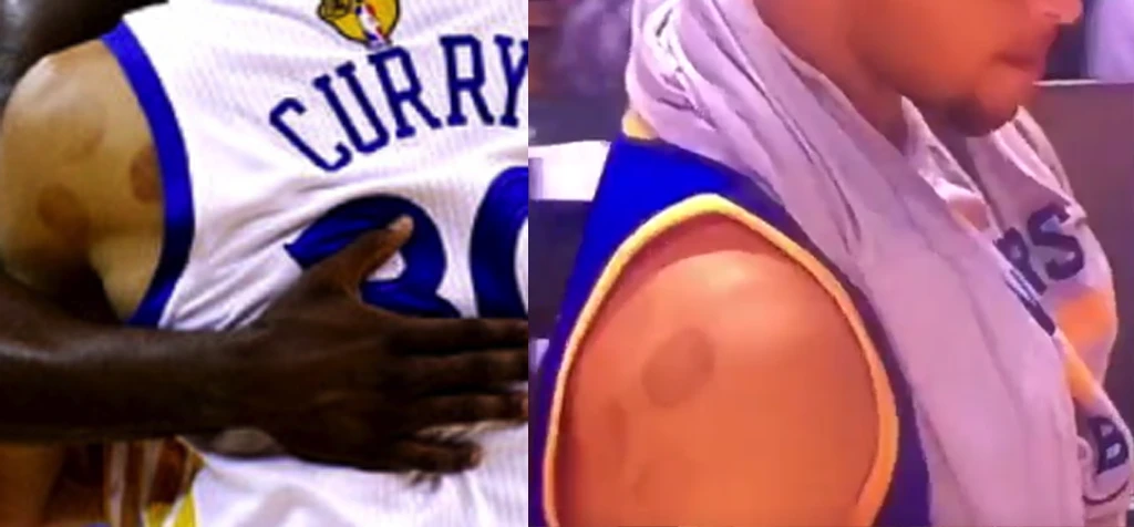 Stephen curry basket cupping