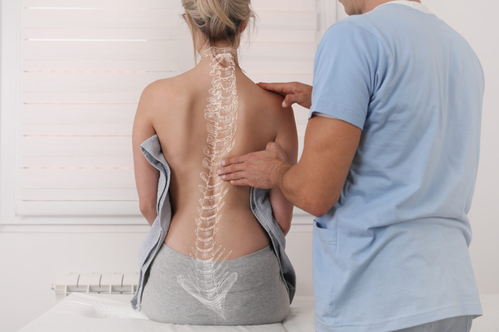 Scoliosis,Spine,Curve,Anatomy,,Posture,Correction.,Chiropractic,Treatment,,Back,Pain