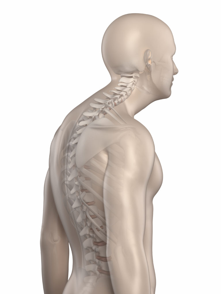 Man,Spine,Kyphosis,Phase,2,Isolated