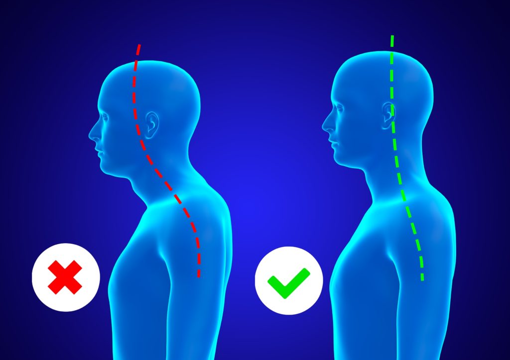 Incorrect,And,Correct,Posture,Of,The,Cervical,Spine,Of,A
