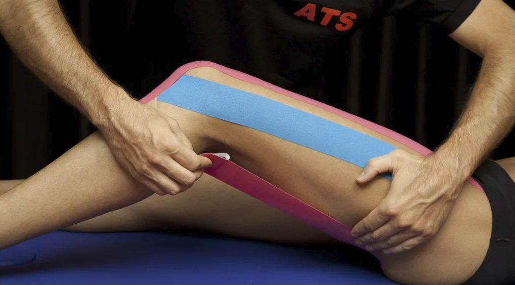 Applicazione stabilizzante con Taping del Legamento crociato anteriore 